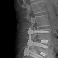 back-xray-side-small